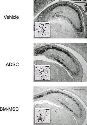 Intravenous Administration of Bone Marrow-Derived Mesenchymal Stem Cell, but not Adipose Tissue-Derived Stem Cell, Ameliorated the Neonatal Hypoxic-Ischemic Brain Injury by Changing Cerebral Inflammatory State in Rat